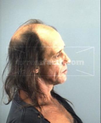 Robert Sidney Lantz