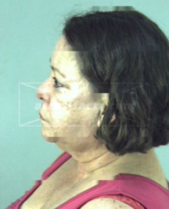 Martha Gomez