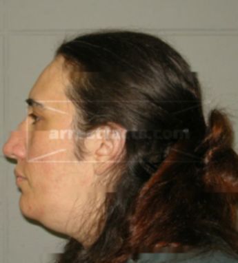 Margaret A Triano