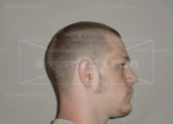 Nicholas J Coakley