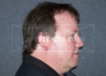 Craig D Moe