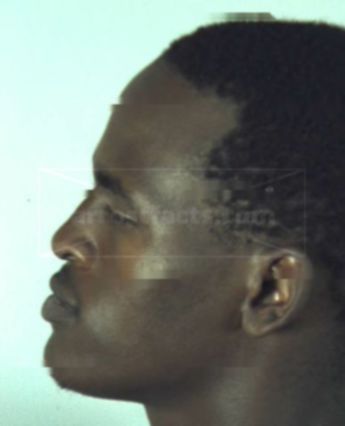Lloyd Maurice Carter