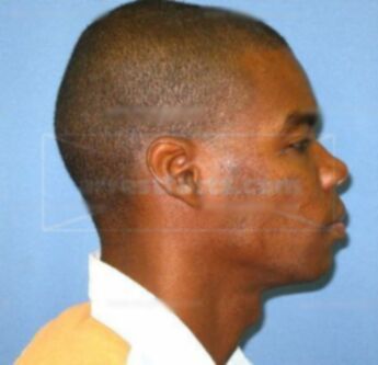 Keith Mckinney