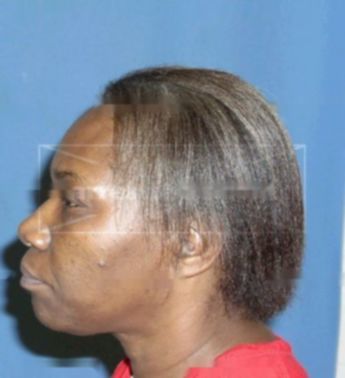 Juanita Barnes