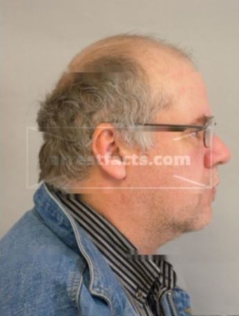 Dean A Dittmann