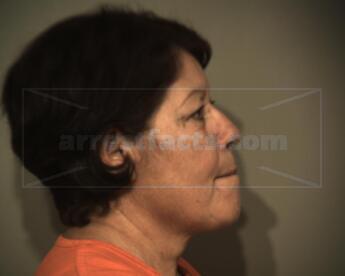 Maria Luisa Baldazo