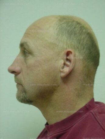 Scott R Long