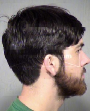 Evan Clayton Moeller