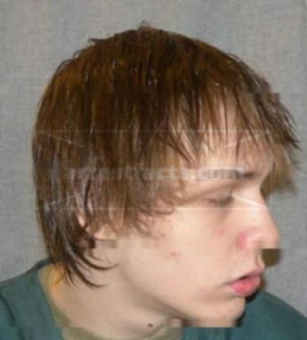 Anthony T Tanner