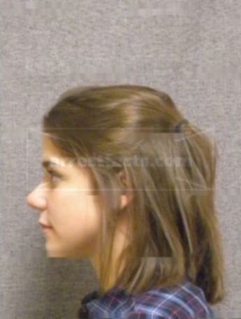 Lexi J Heiser