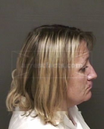 Teresa Lynn Wills