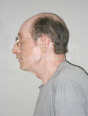 Charles P Nampel