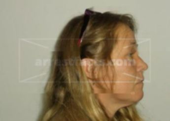Lorie A Baker