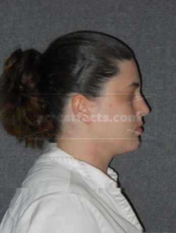 Jennifer B Suckow
