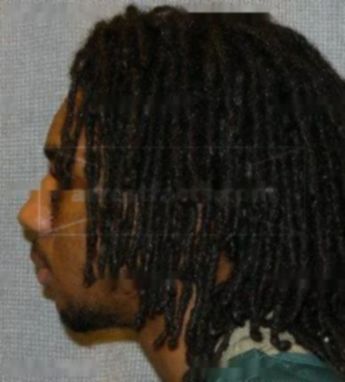 Damion D Robertson