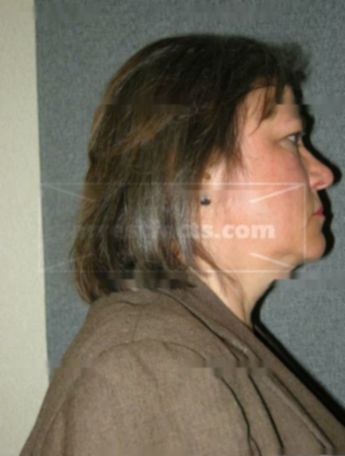Susan M Bergeon