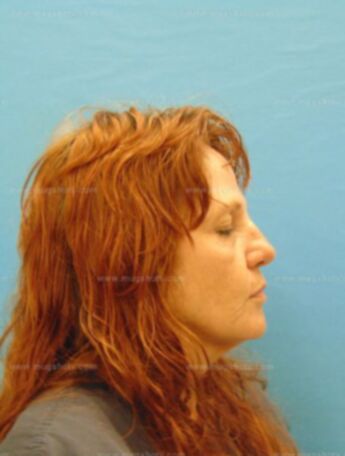 Evonne Alice Brietzke