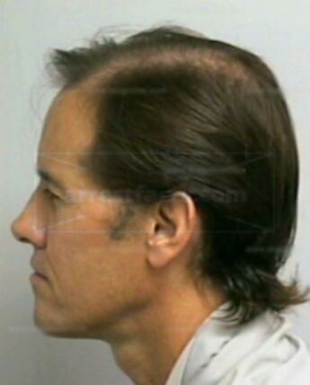 Wesley D Free