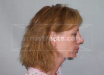 Traci A Carson-Gilbert