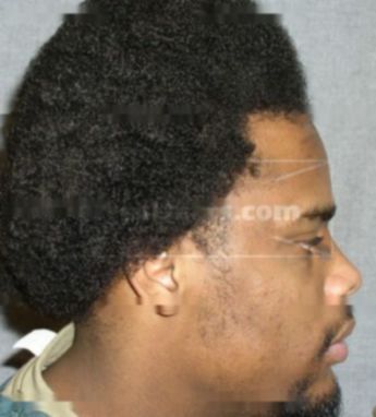 Anthony K Boone