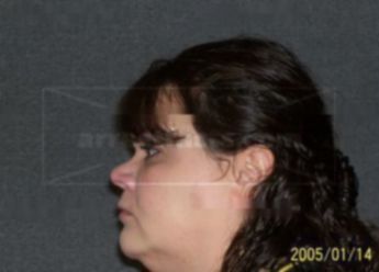 Claudine K Kenyon