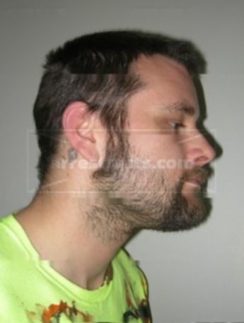 Justin B Fetzer