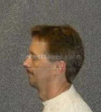 Jeffrey S Zukaitis