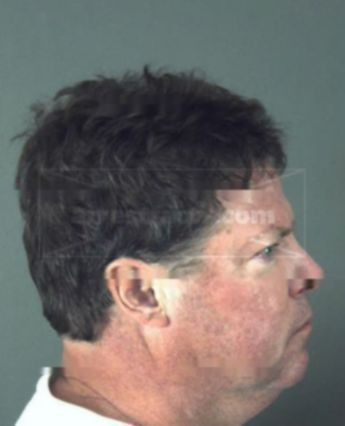 Leonard Ervin Sesniak