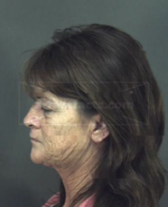 Renee Leslie Watson