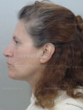 Patricia A Bachim