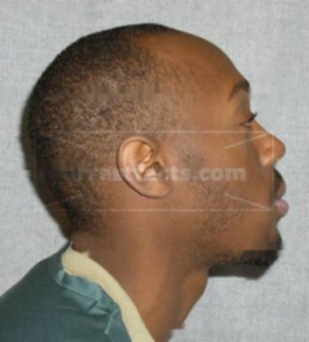 Denorvis Brown