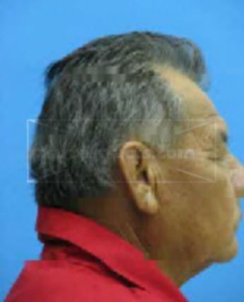 Rosalino Aguirre Chamu