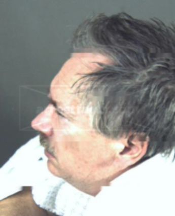 Robert A Schweigel