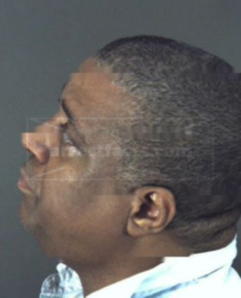 Melvin C Lewis