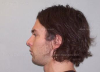 Zachary J Dekker