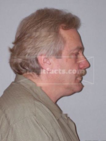 Paul J Koenig
