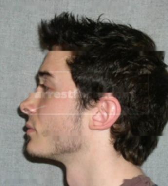 Kevin Pimental