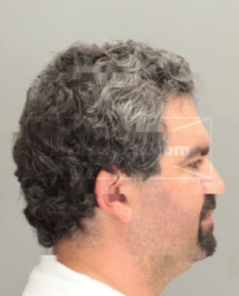 Johnny Bou-Nassar