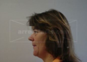 Lynn M Jerovetz