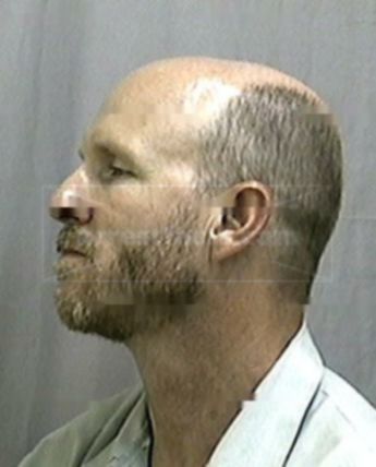 Richard A Olson