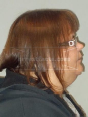 Carol A Zillmer