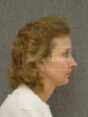 Leslie A Becker