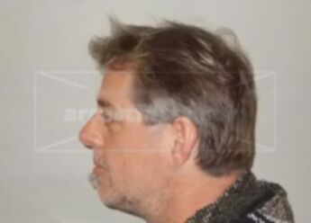 Erik Dennis Bertaud