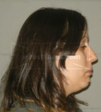 Barbi L Metzger