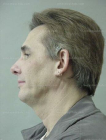 David J Beaulieu