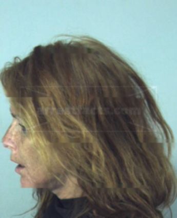 Lori Lynne Mersdorf