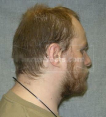 Michael J Villers Jr.