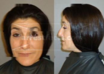 Michele Bella Cassesse