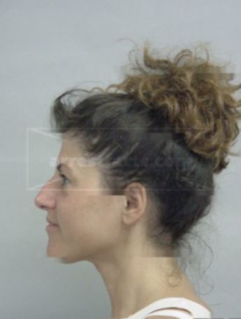 Anne Marie Bottoni