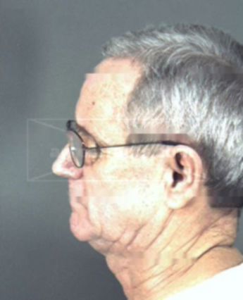 Allen Douglas Cutcher